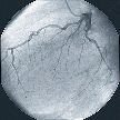 Angiography x-ray