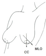 Cranio-caudal & mediolateral oblique view