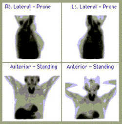 Upper Body Nuclear Medicine Exam