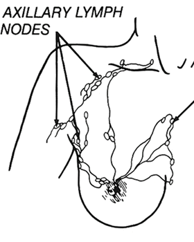 The Importance of Lymph Nodes in Staging Breast Cancer