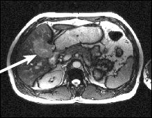 A physican and technologist view a CT scan