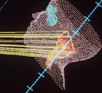 Computer modeling of a radiotherapy beam path