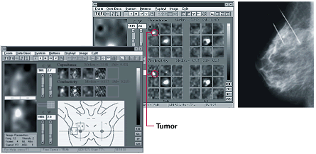 Clinical examples of T-scan results