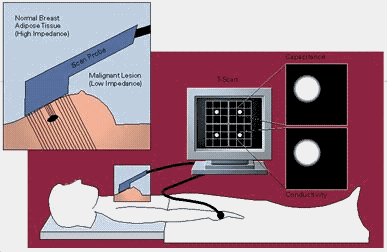 Diagram showing how the T-scan principle works